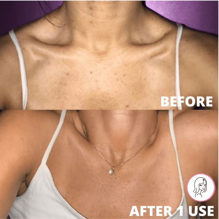 Esfresh - Luva Esfoliante - Shop Da Fábrica