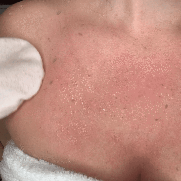 Esfresh - Luva Esfoliante - Shop Da Fábrica